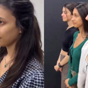 kiz kardeslerin burunlari ucuz oldu KARAITQg